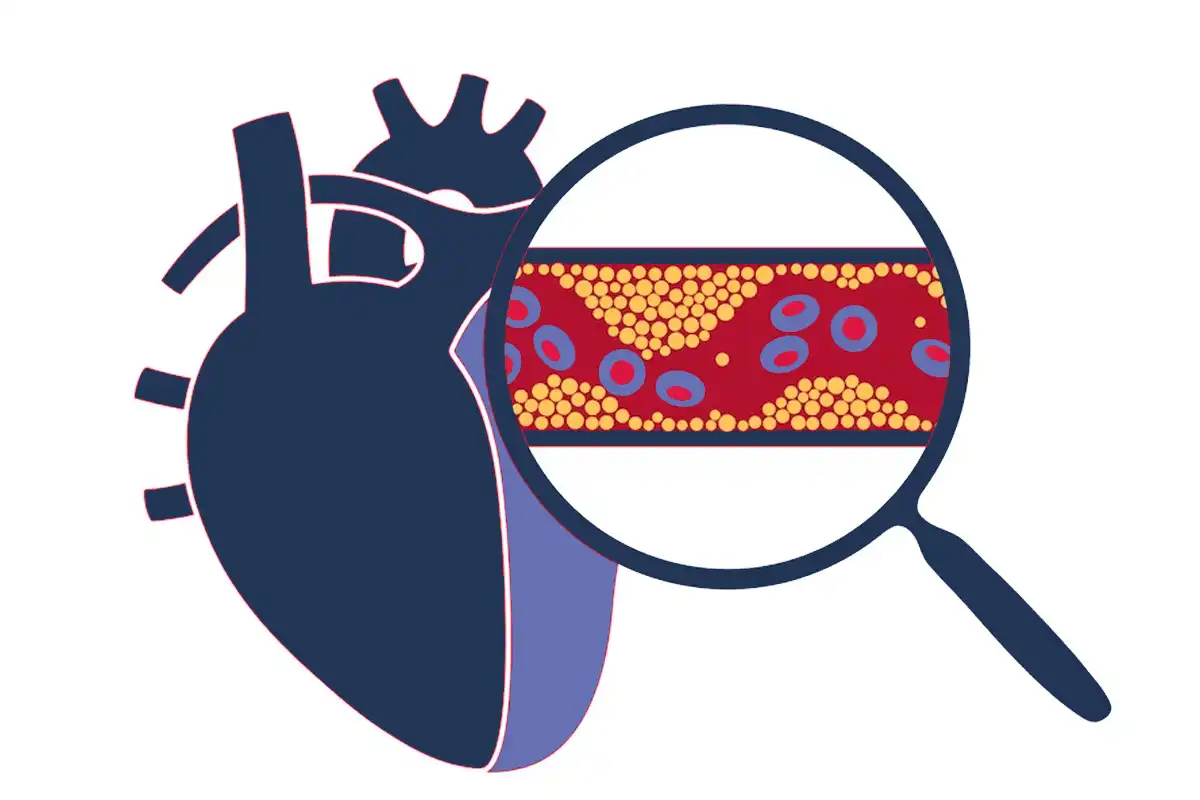 Understanding Cholesterol