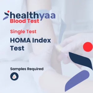 HOMA Index Blood Tests