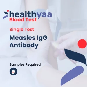 Measles IgG Antibody Blood Tests