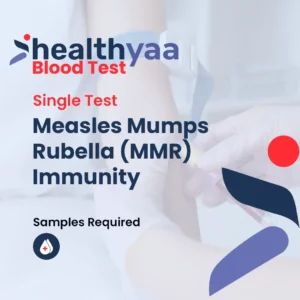 Measles Mumps Rubella Blood Test