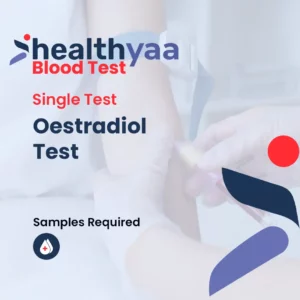 Oestradiol Test E2 Test