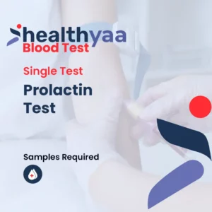 Prolactin Test