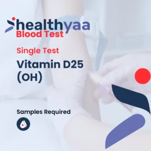 Vitamin D25(OH) Test